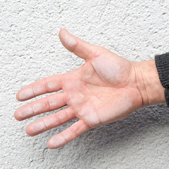 Schritt 1
